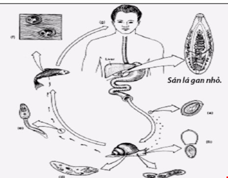 Mê ăn gỏi cá, canh chừng rước sán vào người