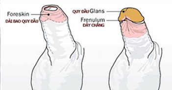 Cắt bao quy đầu có chữa khỏi xuất tinh sớm không